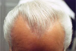 Male Hair example 2 after
